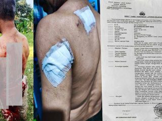 Penganiayaan Berat di Caringin Bogor: Wilson Lalengke Kecam Aksi Main Hakim Sendiri, Desak Polisi Usut Tuntas Terduga Pelaku 'Imron'